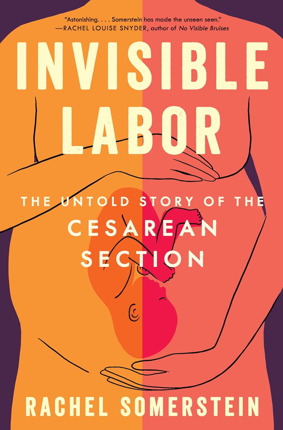 Rachel Somerstein's 'Invisible Birth' chronicles the history of C-sections : NPR - Vimarsana News