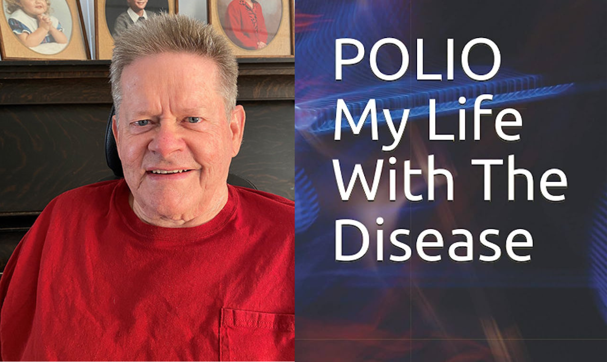 Polio: My Life With The Disease - Vimarsana News